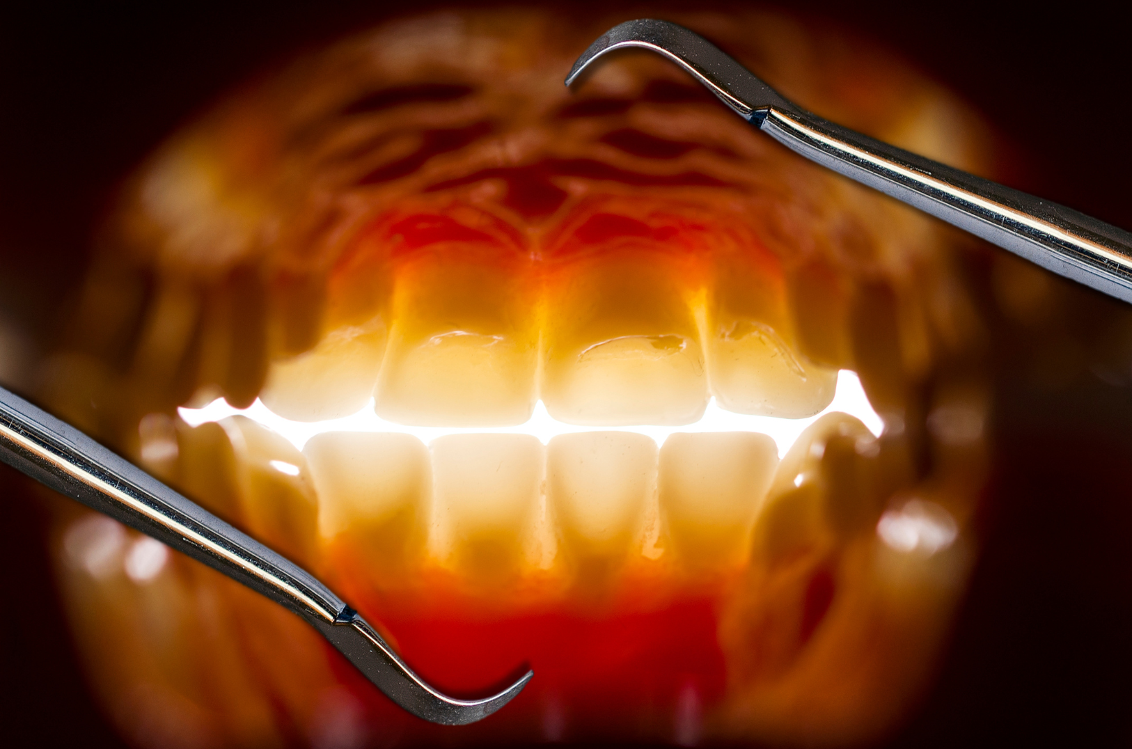 Vue intérieure bouche